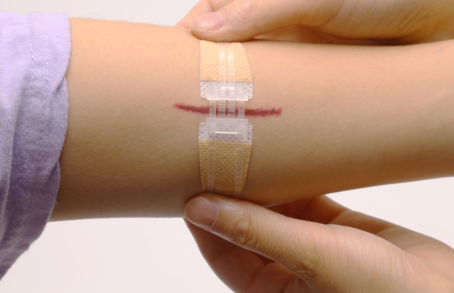 QuickStitch™ Hechtpleister, Naaldloze Hechting (Nu 5 stuks!)