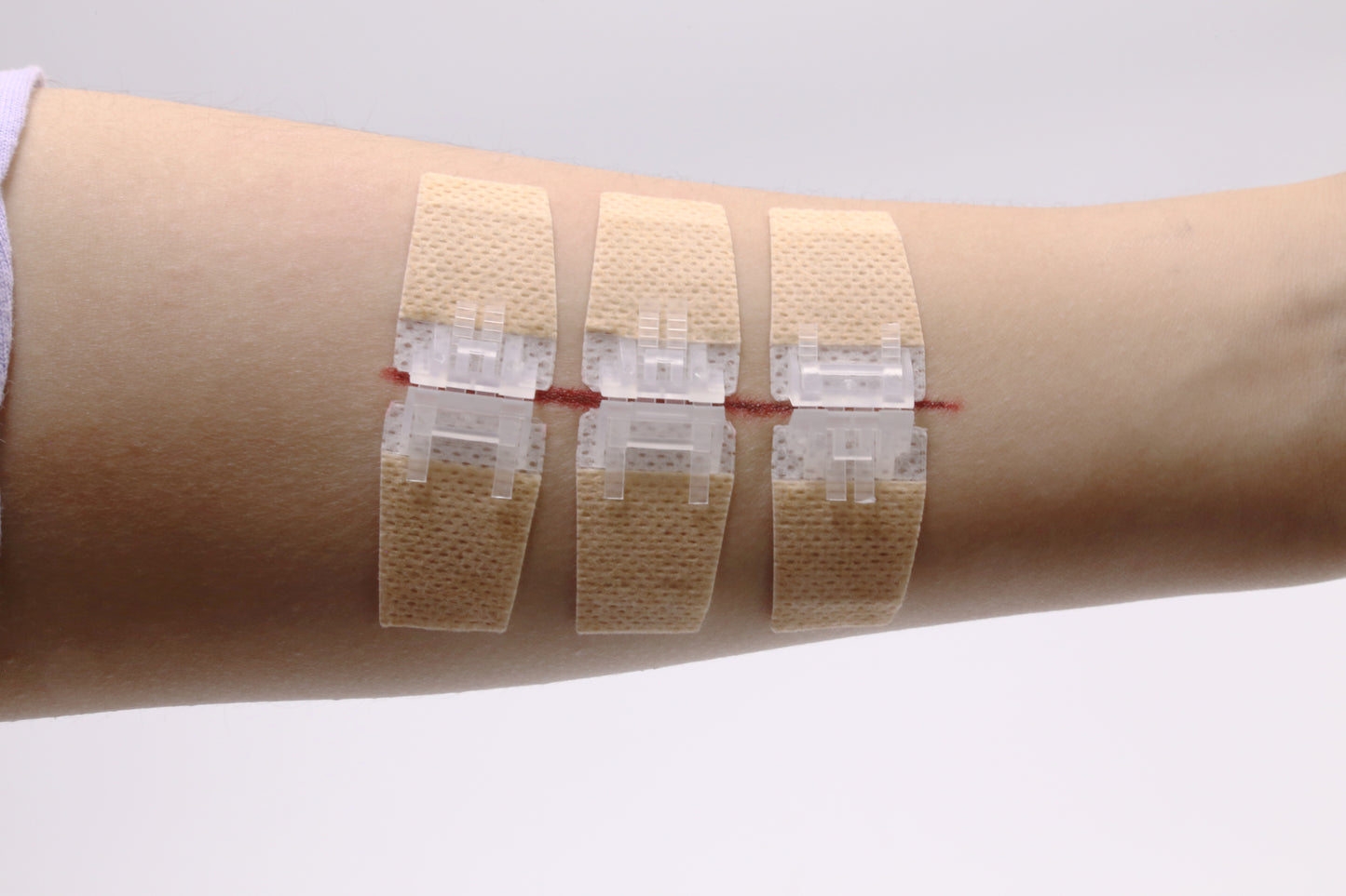 QuickStitch™ Hechtpleister, Naaldloze Hechting (Nu 5 stuks!)
