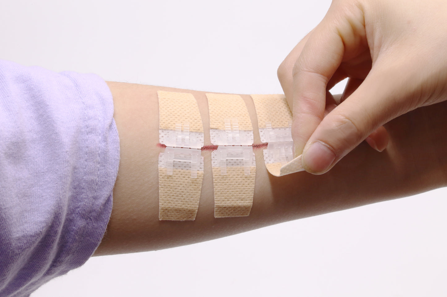 QuickStitch™ Hechtpleister, Naaldloze Hechting (Nu 5 stuks!)